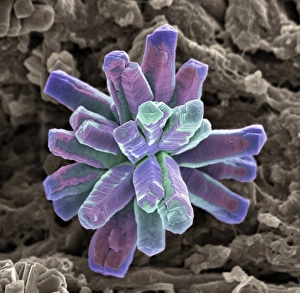 Scanning Electron Microscopy SEM Drucke: Calcium phosphate crystal, SEM