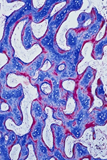 Human Skeletal System Anatomy Drucke: Cancellous bone, light micrograph C016 / 0509