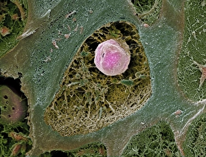 Scanning Electron Micrograph SEM Images Drucke: Cartilage cell, SEM