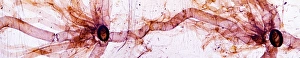 Light Microscopy Images Drucke: Caterpillar spiracles, light micrograph