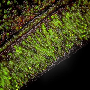 Confocal Microscopy Images Drucke: Cell death