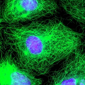 Drucke von Zellteilung. Immunfluozytenlichtmikroskopische Abbildung eines menschlichen Epithelzells (Mitte) während der Interphasenstufe des Mosaizuges Bilder Datiert 2011 August: Zellteilung, fluoreszierendes Mikroskopbild