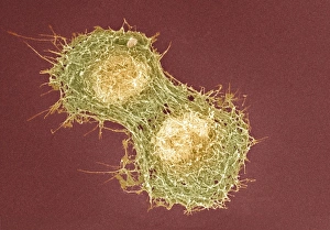 Drucke von Zellteilung. Farbiger Scanningelektronenmikroskopbild von zwei Tierzellen während der Zytokinesis (Zellschmelze) Bilder Datiert 2009 März: Zellteilung, SEM
