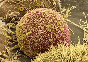 Human Immunodeficiency Virus Drucke: Cell infected with HIV, SEM