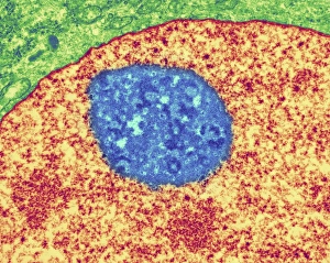 Drucke von Nucleolus. Farbige Transmissionelektronenmikroskopaufnahme des Nukleols (blau), eines Bestandteil der Zellkerne (orange). Die Zellzellenflüssigkeit ist grün Bilder Datiert 2007 Januar: Zellkernnukleolus, TEM