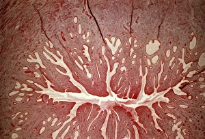 Female Reproductive System Anatomy Drucke: Cervix, light micrograph