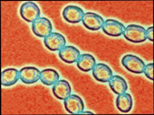 Ketten von Streptococcus pyogenes-Bakterien.