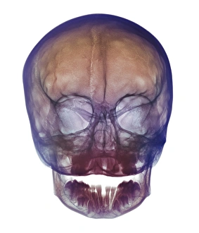 Human Skull Anatomy Drucke: Childs skull