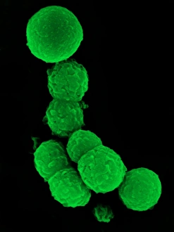 SEM Images Of Bacteria Drucke: Chlamydia bacteria, SEM