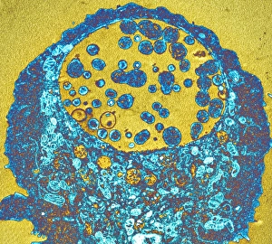 Transmission Electron Micrograph Drucke: Chlamydia bacteria, TEM
