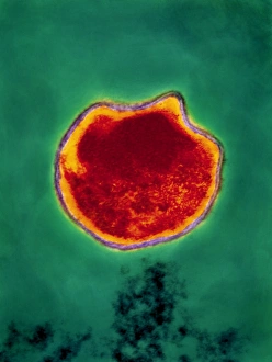 Bilder aus dem Jahr 1994: Chlamydienpneumoniebakterium