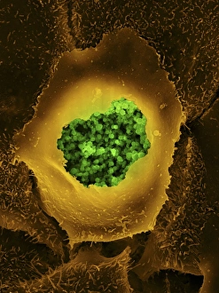 SEM Images Of Bacteria Drucke: Chlamydia, SEM