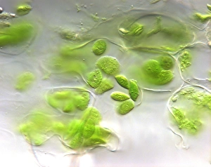Photosynthesis Process Drucke: Chloroplasts, light micrograph