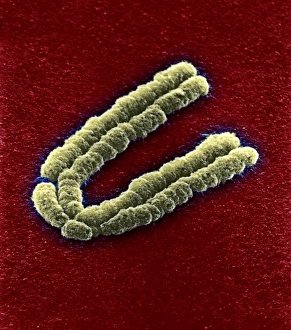 Zygotenmuster, SEM