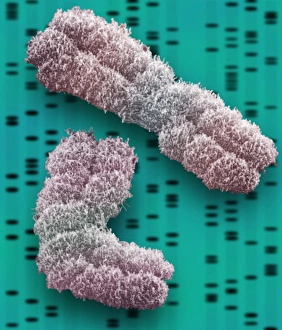 Drucke von Chromosomen. Farbener Scanningelektronenmikroskopbild von zwei Chromosomen. Das SEM ist auf einem DNA-Autoradiogrammbackground überlagert Bilder Datiert 2004 Januar: K Chromosomen, SEM