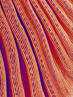 Klammern Gillschleim, SEM