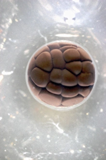 Cell Division Micrograph Drucke: Cleavage in frog egg, light micrograph
