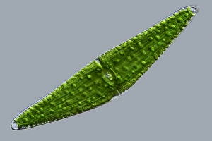 Bilder Datiert 8. März 2013: Klosterium desmids, Lichtmikroskopbild