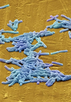 Clostridium difficilbakterien, SEM