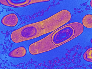 Gerahmter Druck : Clostridium difficilbacterien, TEM Gerahmter Druck : Clostridium difficilbacterien, TEM