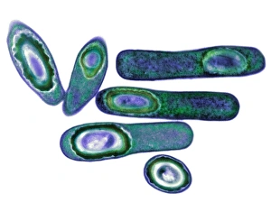 Antibiotic Resistant Bacteria Drucke: Clostridium difficile bacteria, TEM