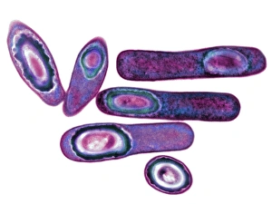 Clostridium difficile Bakterien, TEM