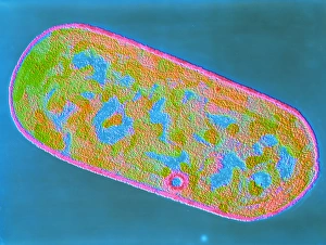 Bilder aus dem Jahr 1987: Clostridium perfringens Bakterium