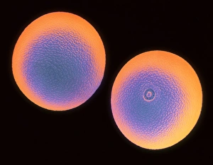 Hay Fever Causes Drucke: Cocksfoot pollen