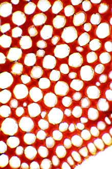 Plant Cell Structure Drucke: Collenchyma plant cells, light micrograph