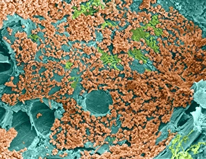 Human Body Bone Structure Drucke: Coloured SEM of bone marrow in spongy bone
