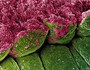 Coloured SEM Images Drucke: Coloured SEM of iris epithelial cells of the eye