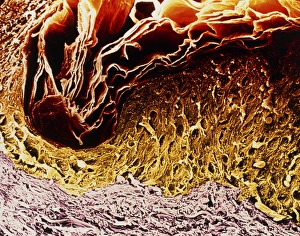 Human Skin Anatomy Drucke: Coloured SEM of a section through skin