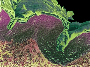 Epidermis And Dermis Layers Drucke: Coloured SEM of a section through skin layers