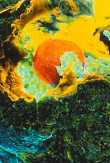 Bilder aus dem Jahr 1994: Farbige SEM-Untersuchung zeigt den Ovulationsprozess