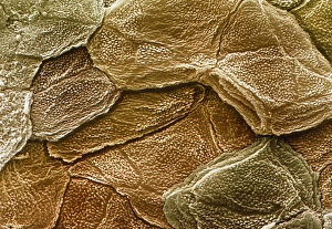 Human Skin SEM Drucke: Coloured SEM of the surface of human skin