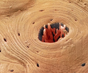 Drucke von Kompakter Knochen. Farbkolorierte Rasterelektronenmikrographie (SEM) einer Querschnittsabbildung von kompaktem Knochen Bilder Datiert 2002 September: Farbiger SEM-Aufnahme einer Querschnittszeichnung von kompakter Knochen.