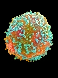 Menschlicher Körper Drucke: Farbener SEM-Bildung eines weißen Blutkörperszellen (Lymphozyt)