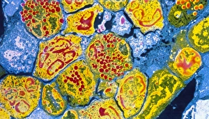 Human Bone Anatomy Drucke: Coloured TEM of cells in bone marrow