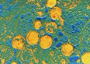 TEM Micrograph Drucke: Coloured TEM of Chlamydia sp. bacteria