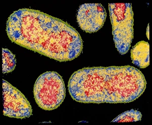Coloured Electron Micrograph Drucke: Coloured TEM of E. coli bacterium