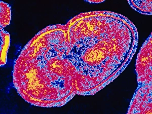 Bilder aus dem Jahr 1994: Farbtem von Einerbacillus faecalis