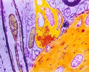 Farbtem von einer Nervenfortpflanzung