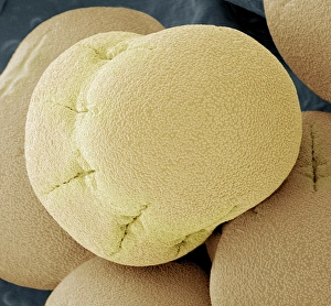 Pollen Grain Structure Drucke: Comfrey pollen, SEM