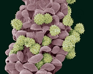 Bilder vom 29. September 2010: Gemeiner Knopfblütenkegel, SEM