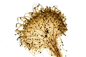 Drosera Rotundifolia Drucke: Common sundew, light micrograph