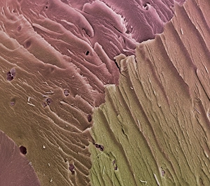 Knee Joint Anatomy Drucke: Compact bone, SEM