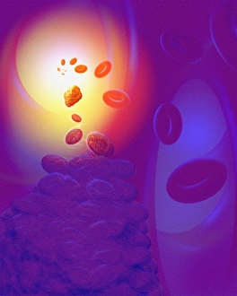 Blood Clot Formation Drucke: Computer artwork of a blood clot