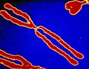 DNA Structure Drucke: Computer-enhanced LM of human chromosomes