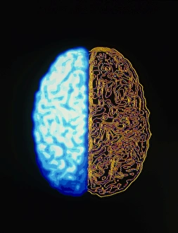 Central Nervous System Drucke: Computer graphic of superior surface of brain