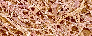 Scanning Electron Micrograph SEM Images Drucke: Connective tissue, SEM C015 / 9926